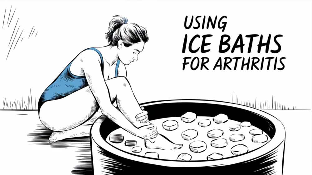 Ice Baths and Arthritis